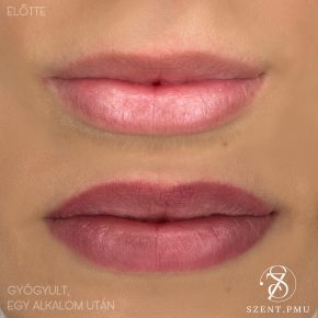 A44E4ED3-E386-4D51-83A8-C0D76EF308AA