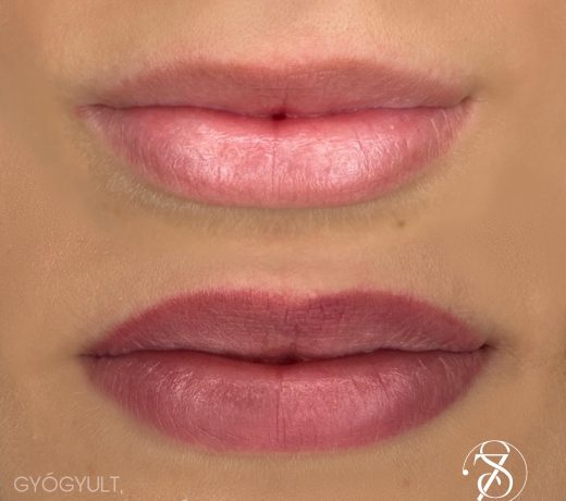 A44E4ED3-E386-4D51-83A8-C0D76EF308AA